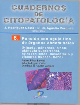 CUADERNOS DE CITOPATOLOGÍA 06: PUNCIÓN CON AGUJA FINA DE ÓRGANOS ABDOMINALES