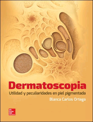 DERMATOSCOPIA