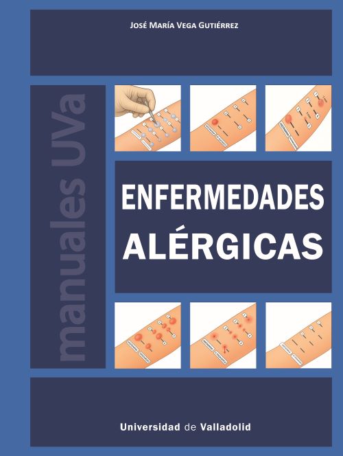 ENFERMEDADES ALÉRGICAS
