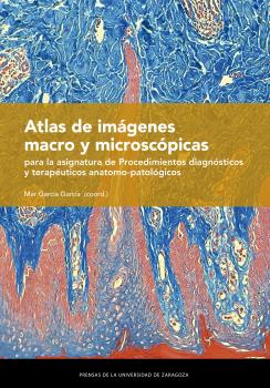 ATLAS DE IMÁGENES MACRO Y MICROSCÓPICAS PARA LA ASIGNATURA DE  PROCEDIMIENTOS DIAGNÓSTICOS Y TERAPÉUTICOS ANATOMO-PATOLÓGICOS