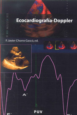 ECOCARDIOGRAFIA DOPPLER