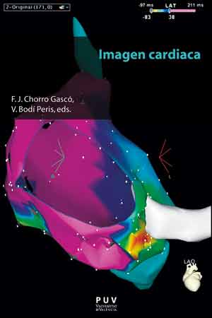 IMAGEN CARDIACA