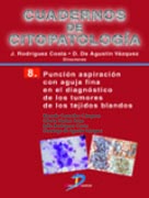 CUADERNOS DE CITOPATOLOGÍA 08: PUNCIÓN ASPIRACIÓN CON AGUJA FINA EN EL DIAGNÓSITCO DE LOS TUMORES DE LOS TEJIDO