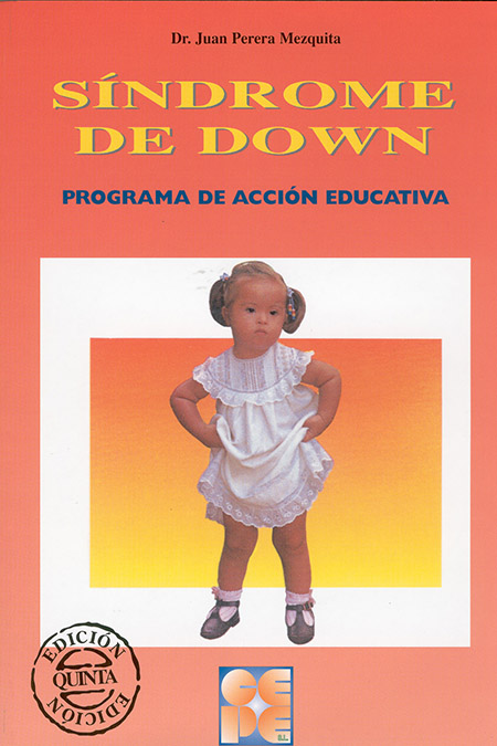 SINDROME DE DOWN