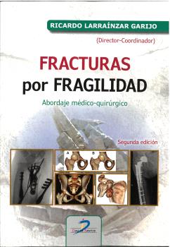 FRACTURAS POR FRAGILIDAD