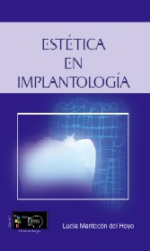 ESTETICA EN IMPLANTOLOGIA