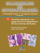 CUADERNOS DE CITOPATOLOGÍA 11: PUNCIÓN ASPIRACIÓN CON AGUJA FINA EN EL DIAGNÓSTICO DE LOS TUMORES DE HUESO