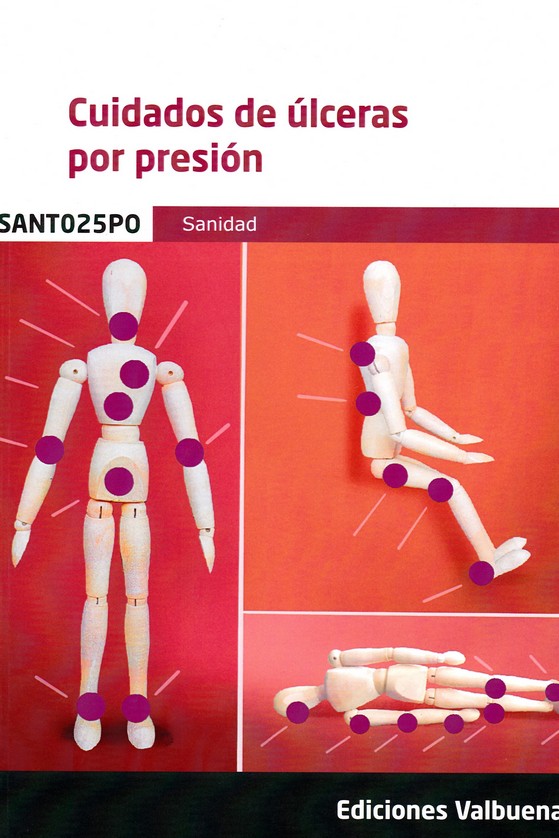 CUIDADOS DE ULCERAS POR PRESION ( SANIDAD)