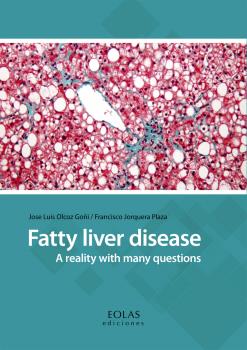 FATTY LIVER DISEASE. A REALITY WITH MANY QUESTIONS